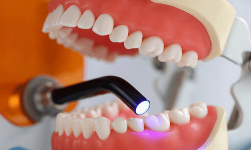 Periodoncia dental