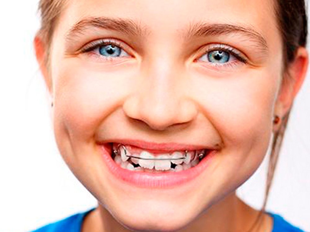 Ortodoncia infantil en Plasencia
